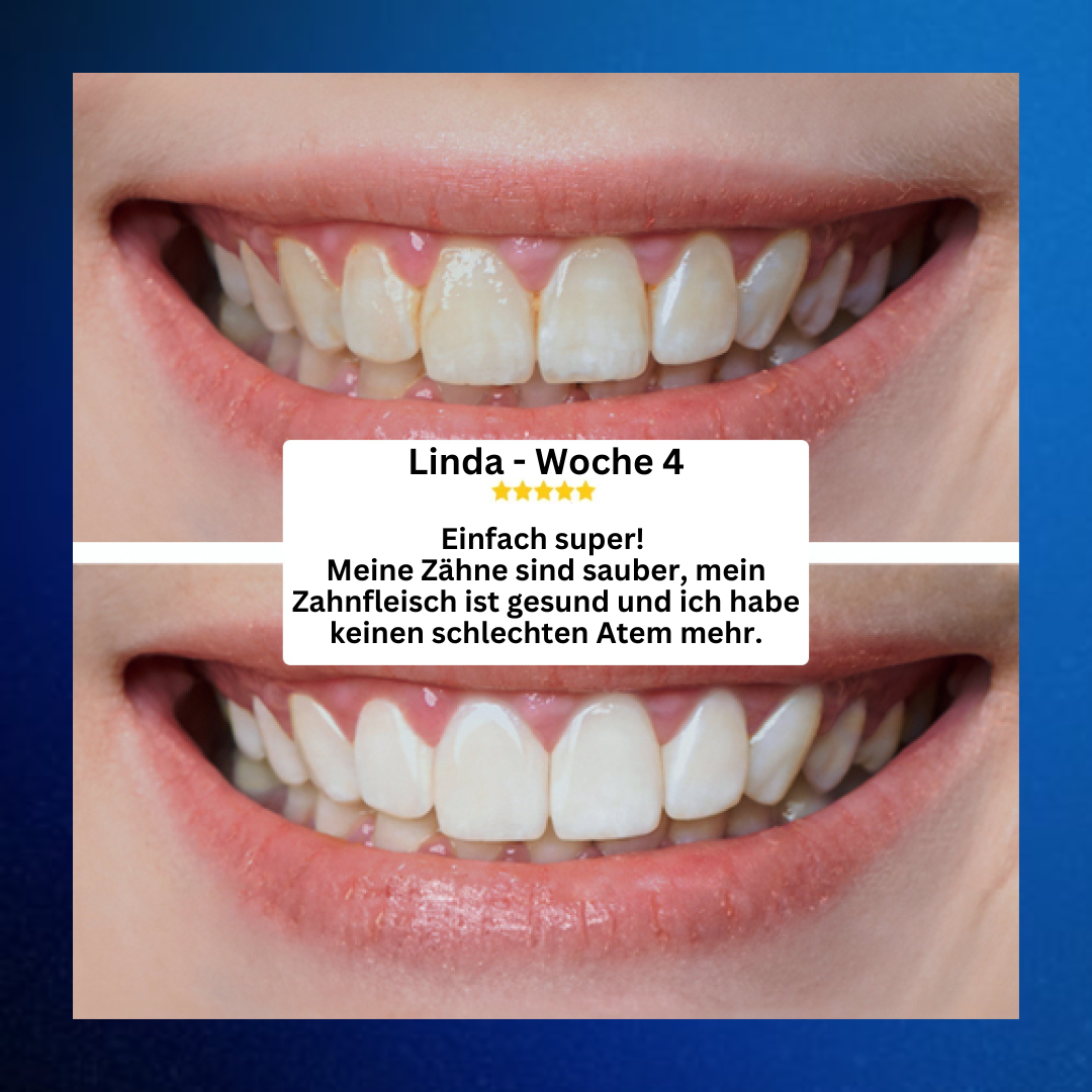 Aqua Pro™  Munddusche für tiefenreine Zähne