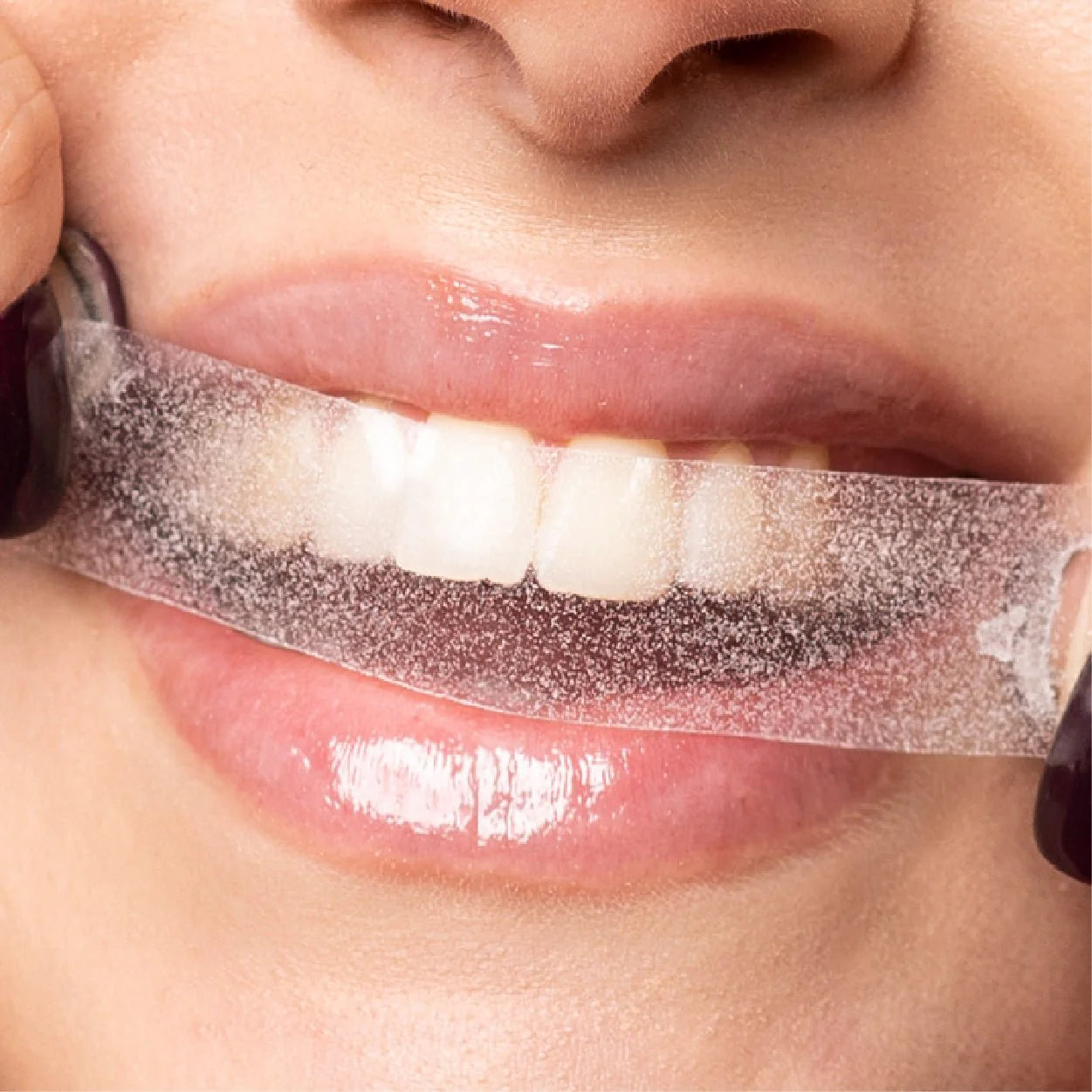 Aqua Smile™ Aufhellungsstreifen
